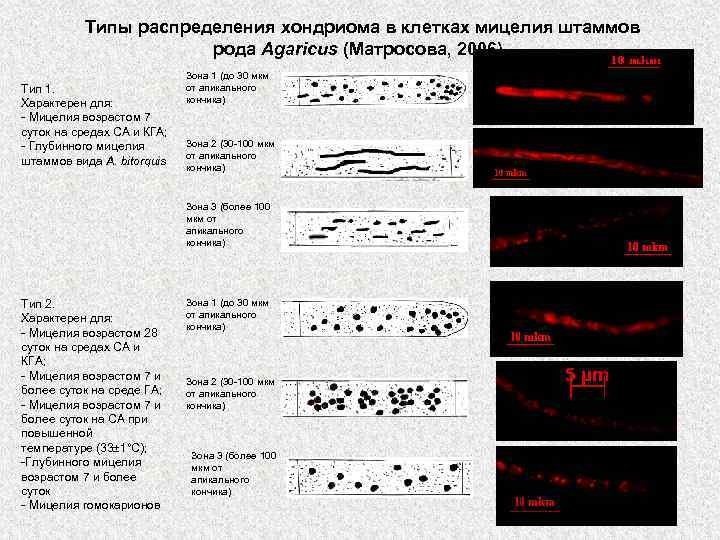 Типы распределения хондриома в клетках мицелия штаммов рода Agaricus (Матросова, 2006). Тип 1. Характерен