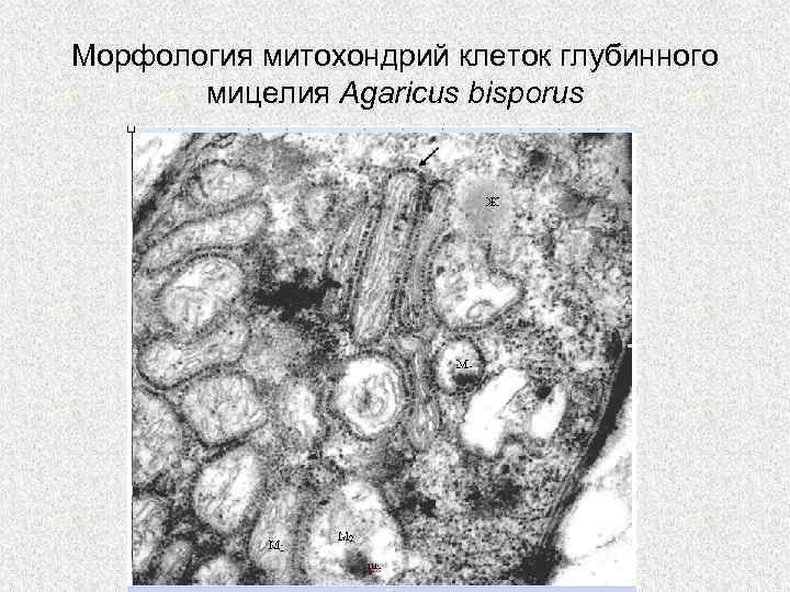 Морфология митохондрий клеток глубинного мицелия Agaricus bisporus 