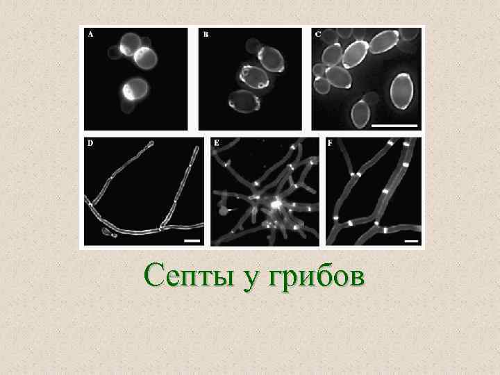 Септы у грибов 