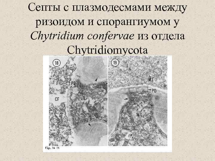 Септы с плазмодесмами между ризоидом и спорангиумом у Chytridium confervae из отдела Chytridiomycota 