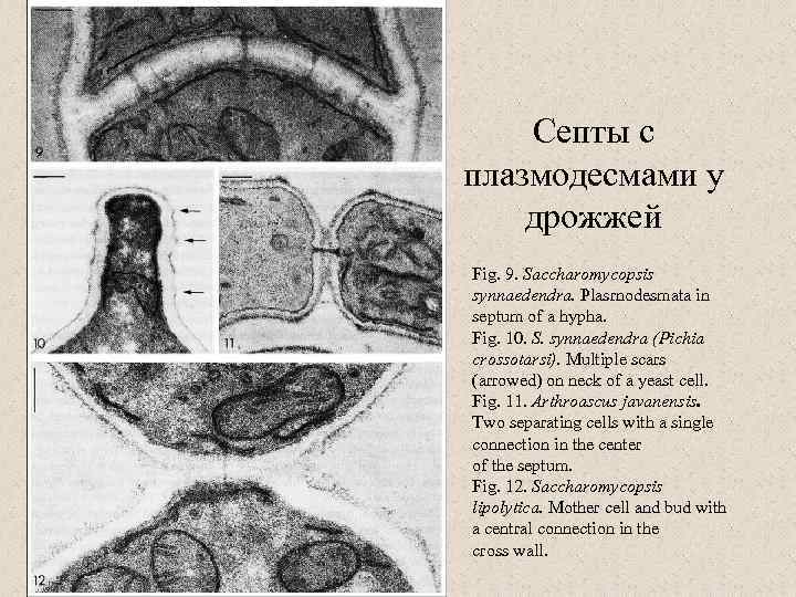 Септы с плазмодесмами у дрожжей Fig. 9. Saccharomycopsis synnaedendra. Plasrnodesmata in septum of a