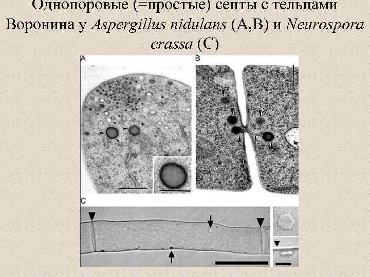 Однопоровые (=простые) септы с тельцами Воронина у Aspergillus nidulans (А, В) и Neurospora crassa