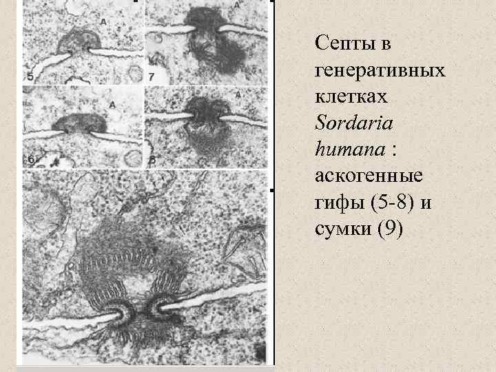 Септы в генеративных клетках Sordaria humana : аскогенные гифы (5 -8) и сумки (9)