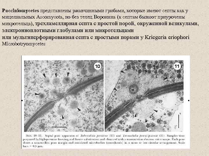 Pucciniomycetes представлены ржавчинными грибами, которые имеют септы как у мицелиальных Ascomycota, но без телец