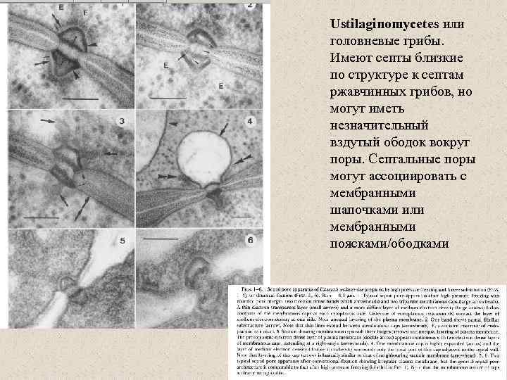 Ustilaginomycetes или головневые грибы. Имеют септы близкие по структуре к септам ржавчинных грибов, но