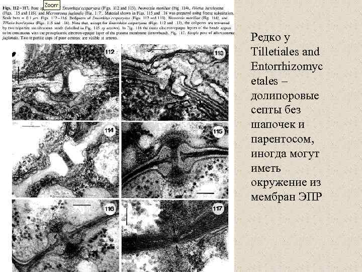 Редко у Tilletiales and Entorrhizomyc etales – долипоровые септы без шапочек и парентосом, иногда