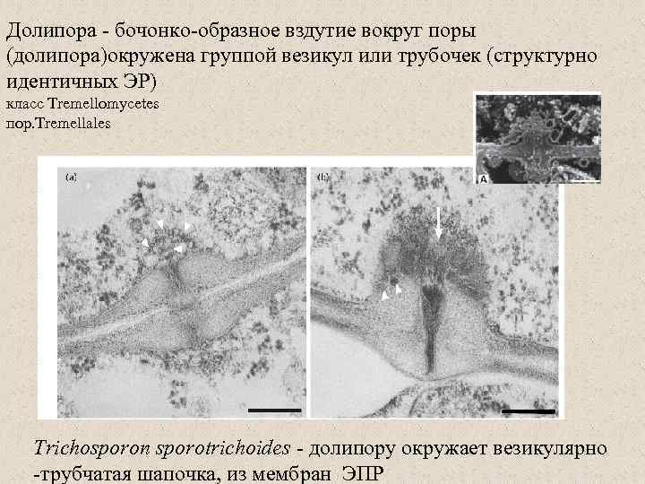 Долипора - бочонко-образное вздутие вокруг поры (долипора)окружена группой везикул или трубочек (структурно идентичных ЭР)