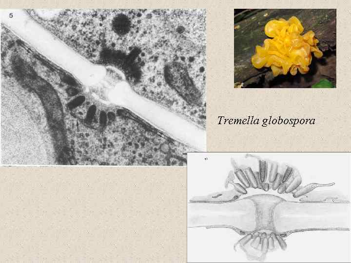 Tremella globospora 