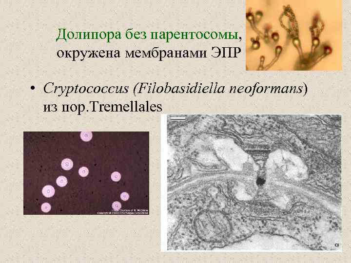 Долипора без парентосомы, окружена мембранами ЭПР • Cryptococcus (Filobasidiella neoformans) из пор. Tremellales 