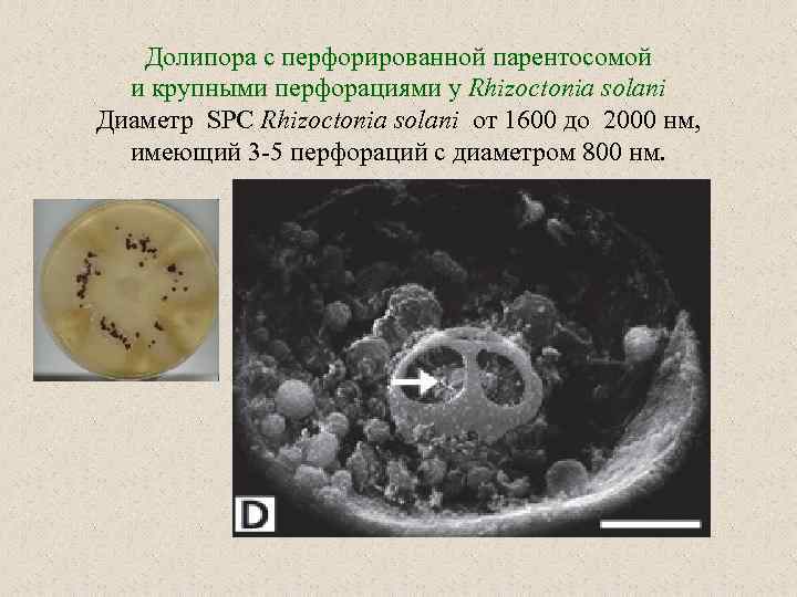 Долипора с перфорированной парентосомой и крупными перфорациями у Rhizoctonia solani Диаметр SPC Rhizoctonia solani