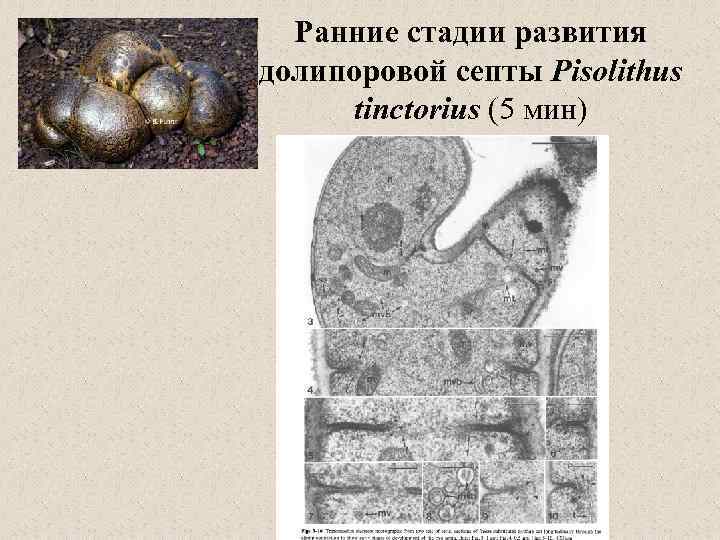 Ранние стадии развития долипоровой септы Pisolithus tinctorius (5 мин) 