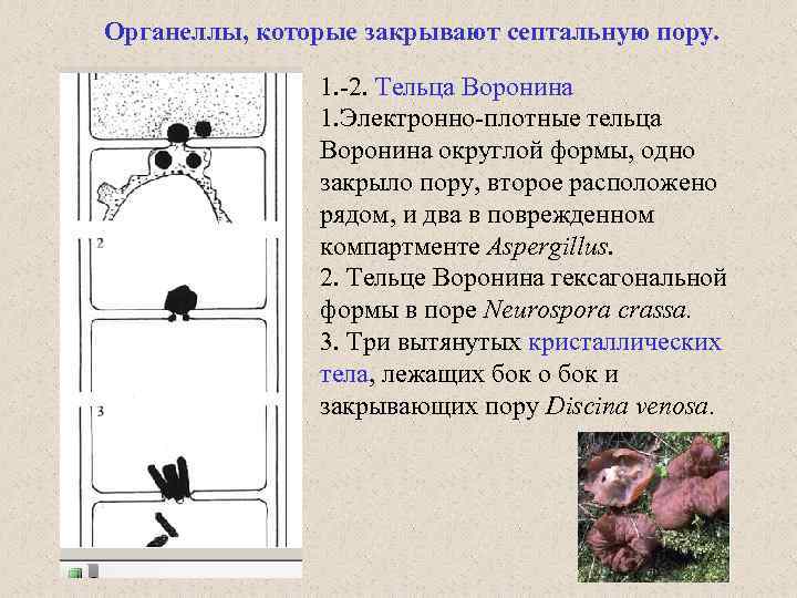 Органеллы, которые закрывают септальную пору. 1. -2. Тельца Воронина 1. Электронно-плотные тельца Воронина округлой