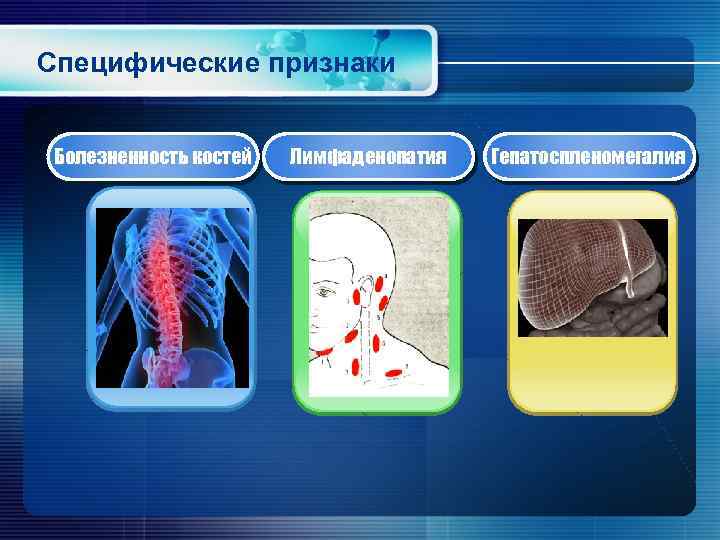 Специфические признаки Болезненность костей Лимфаденопатия Гепатоспленомегалия 