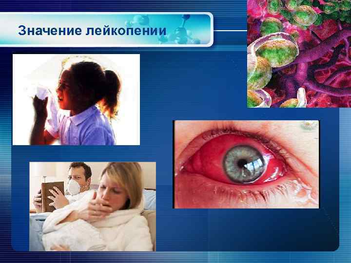 Значение лейкопении 