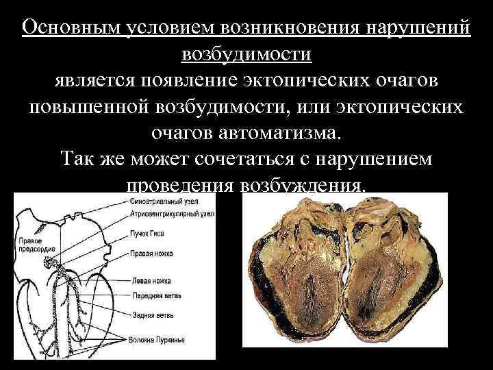 Презентация сократимость сердечной мышцы