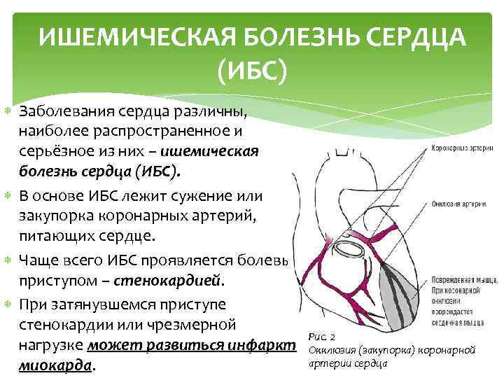 ИШЕМИЧЕСКАЯ БОЛЕЗНЬ СЕРДЦА (ИБС) Заболевания сердца различны, наиболее распространенное и серьёзное из них –