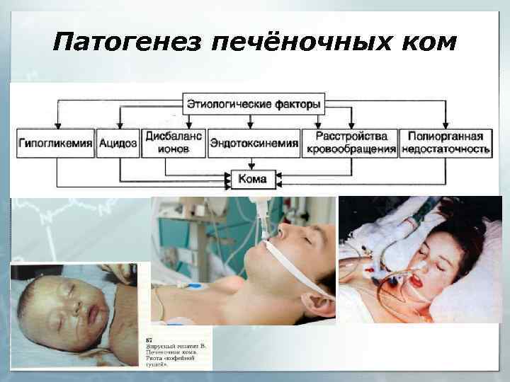 Патогенез печёночных ком 