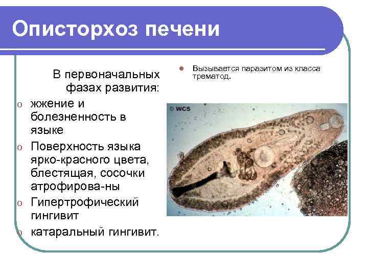 На фото представлено поражение печени вписать название червя в соответствующем падеже