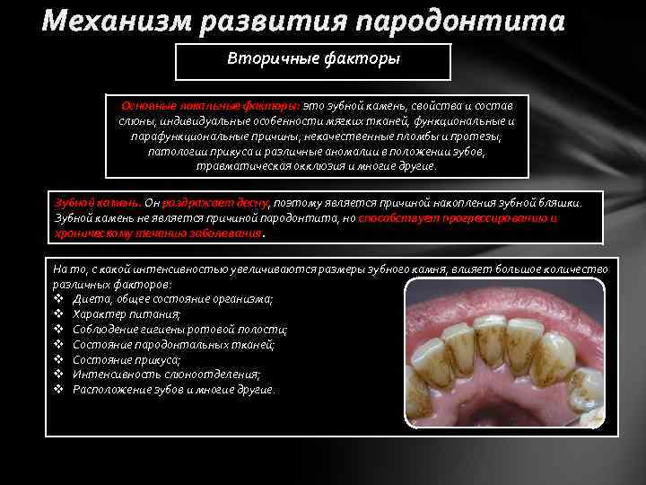 Механизм развития пародонтита Вторичные факторы Основные локальные факторы: это зубной камень, свойства и состав