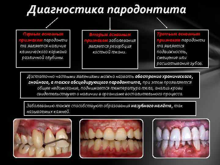 Классификация заболеваний пародонта презентация