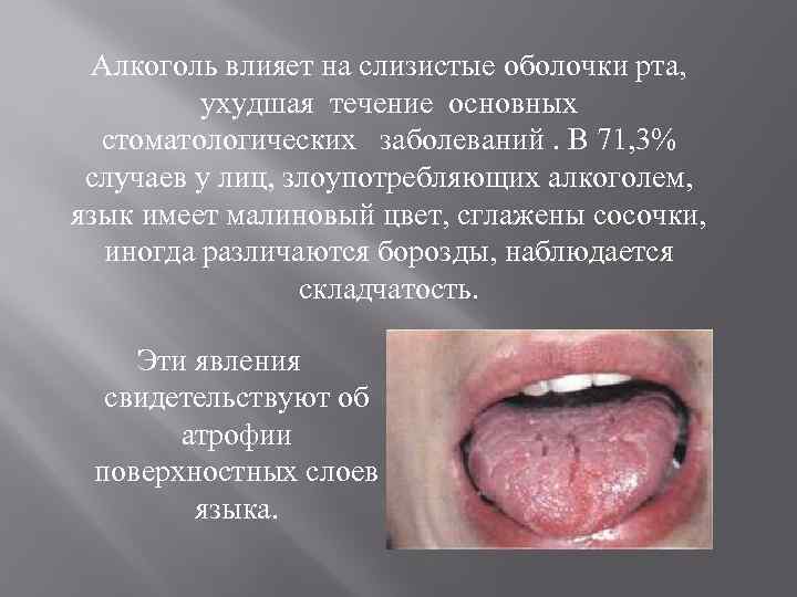Алкоголь влияет на слизистые оболочки рта, ухудшая течение основных стоматологических заболеваний. В 71, 3%
