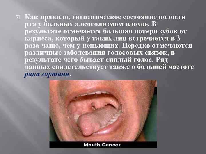  Как правило, гигиеническое состояние полости рта у больных алкоголизмом плохое. В результате отмечается