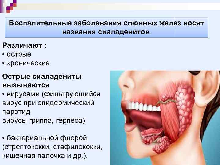 Воспалительные заболевания слюнных желез носят названия сиаладенитов. Различают : • острые • хронические Острые
