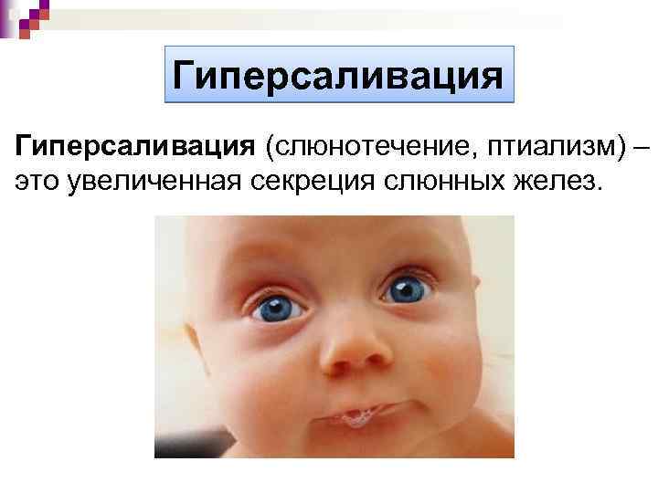 Гиперсаливация (слюнотечение, птиализм) – это увеличенная секреция слюнных желез. 