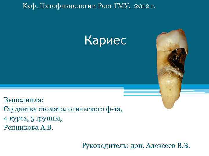 Каф. Патофизиологии Рост ГМУ, 2012 г. Кариес Выполнила: Студентка стоматологического ф-та, 4 курса, 5