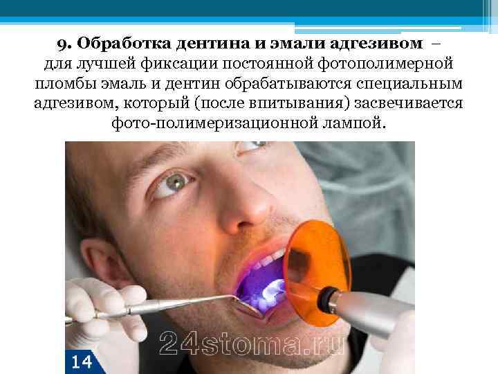9. Обработка дентина и эмали адгезивом – для лучшей фиксации постоянной фотополимерной пломбы эмаль