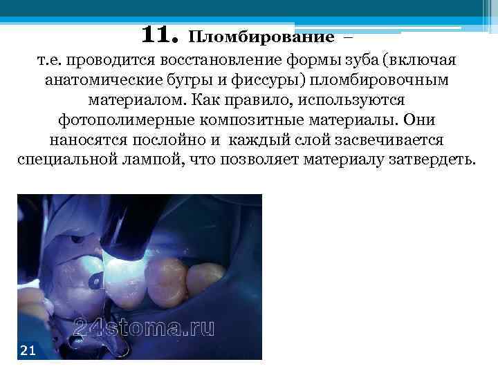 11. Пломбирование – т. е. проводится восстановление формы зуба (включая анатомические бугры и фиссуры)