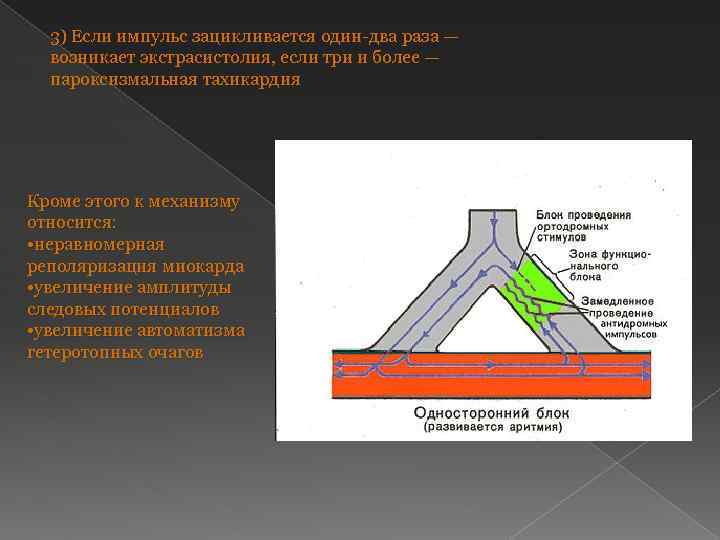 3) Если импульс зацикливается один-два раза — возникает экстрасистолия, если три и более —