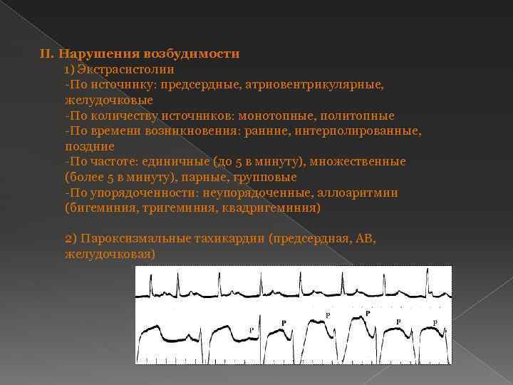 II. Нарушения возбудимости 1) Экстрасистолии -По источнику: предсердные, атриовентрикулярные, желудочковые -По количеству источников: монотопные,