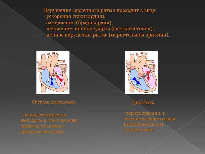 Нарушение сердечного ритма проходит в виде: - ускорения (тахикардия); - замедления (брадикардия); - появление