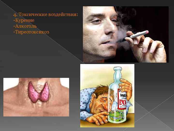 4. Токсические воздействия: -Курение -Алкоголь -Тиреотоксикоз 