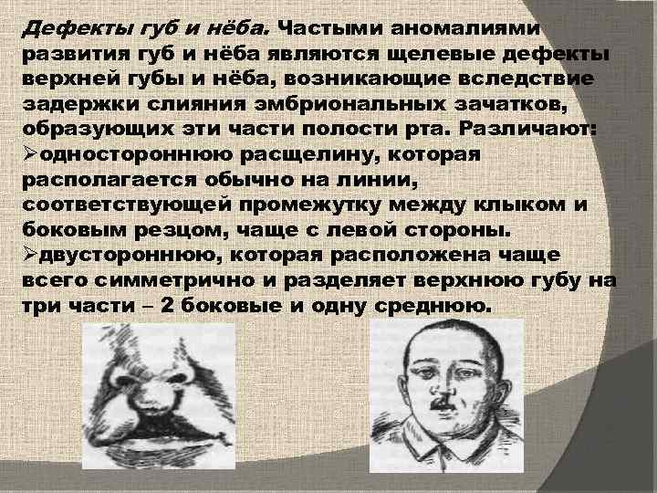 Дефекты губ и нёба. Частыми аномалиями развития губ и нёба являются щелевые дефекты верхней