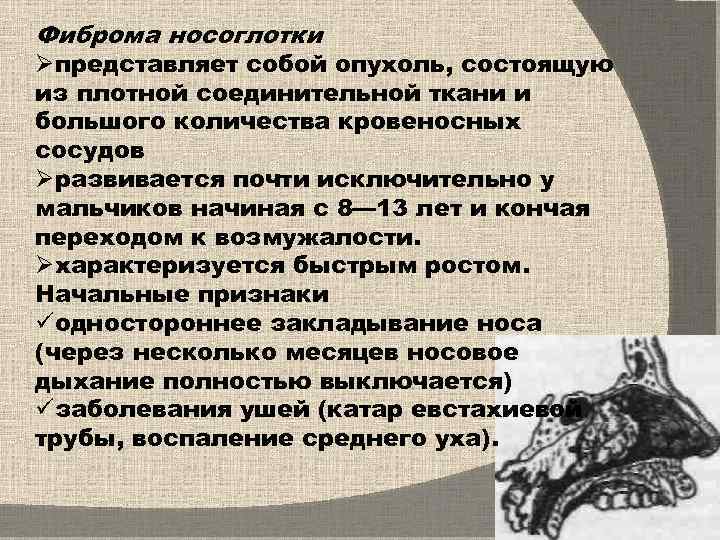 Фиброма носоглотки Øпредставляет собой опухоль, состоящую из плотной соединительной ткани и большого количества кровеносных