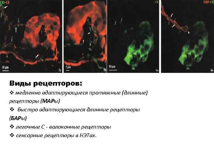 Виды рецепторов: v медленно адаптирующиеся протяжные (длинные) рецепторы (МАРы) v быстро адаптирующиеся длинные рецепторы
