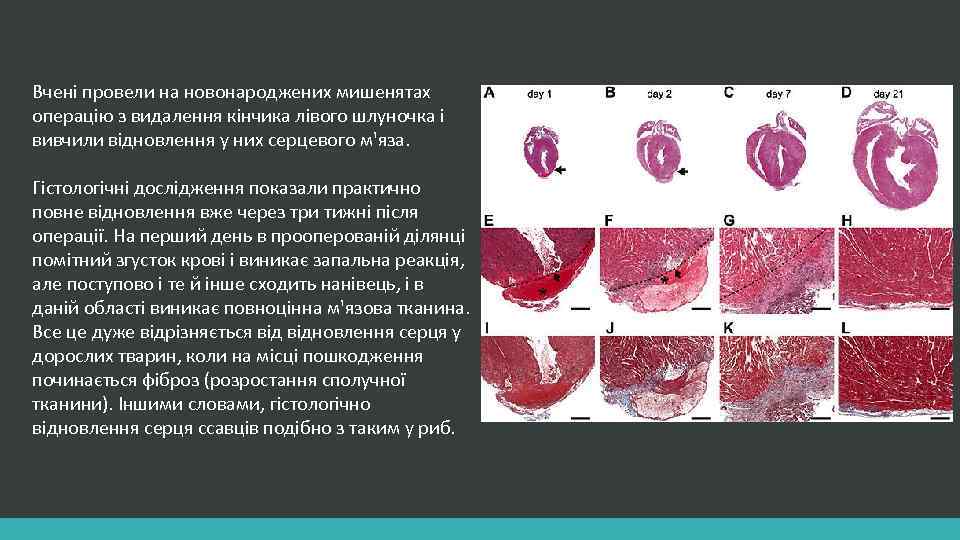 Вчені провели на новонароджених мишенятах операцію з видалення кінчика лівого шлуночка і вивчили відновлення
