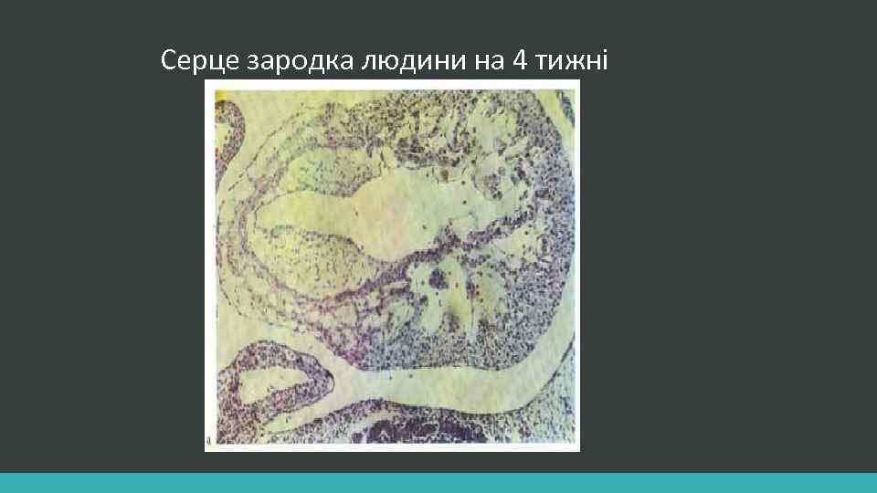 Серце зародка людини на 4 тижні 