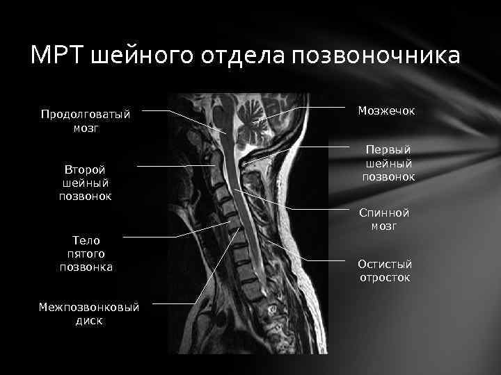 Рентген шейного отдела здорового человека фото