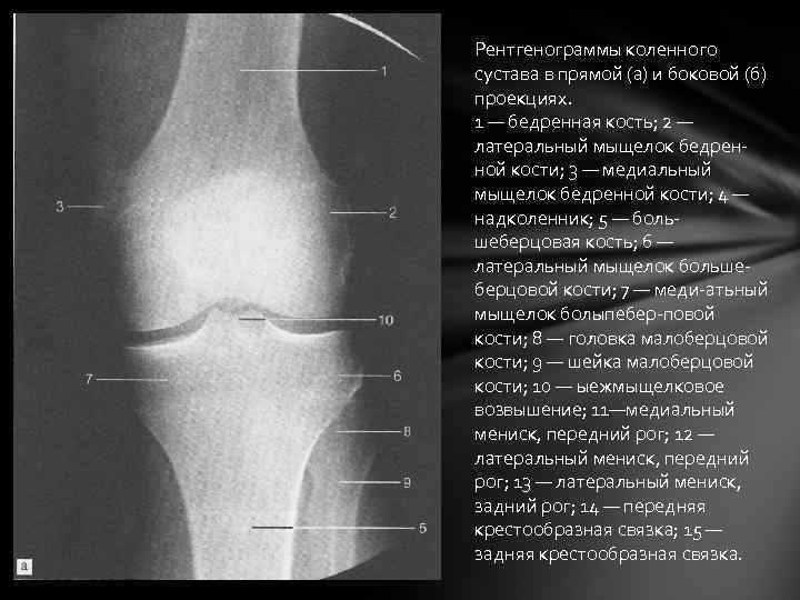 Коленный сустав рентген