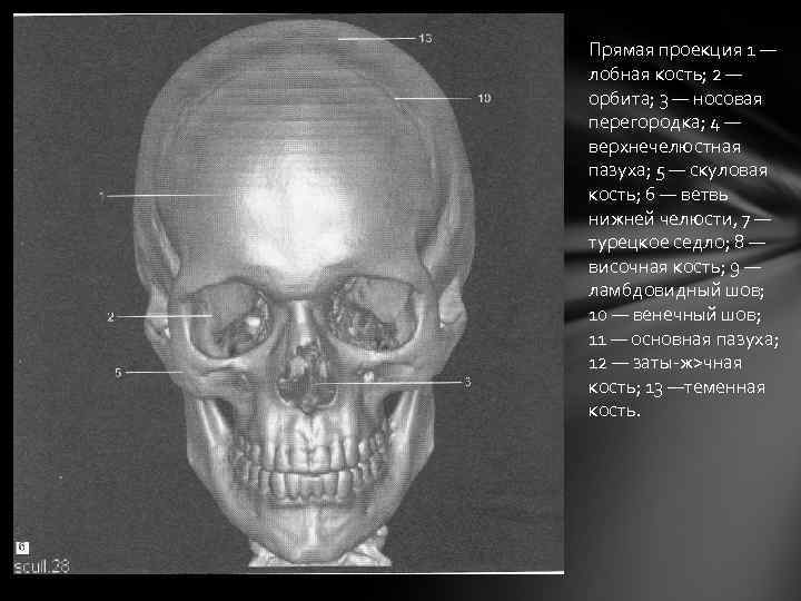 Прямая проекция 1 — лобная кость; 2 — орбита; 3 — носовая перегородка; 4