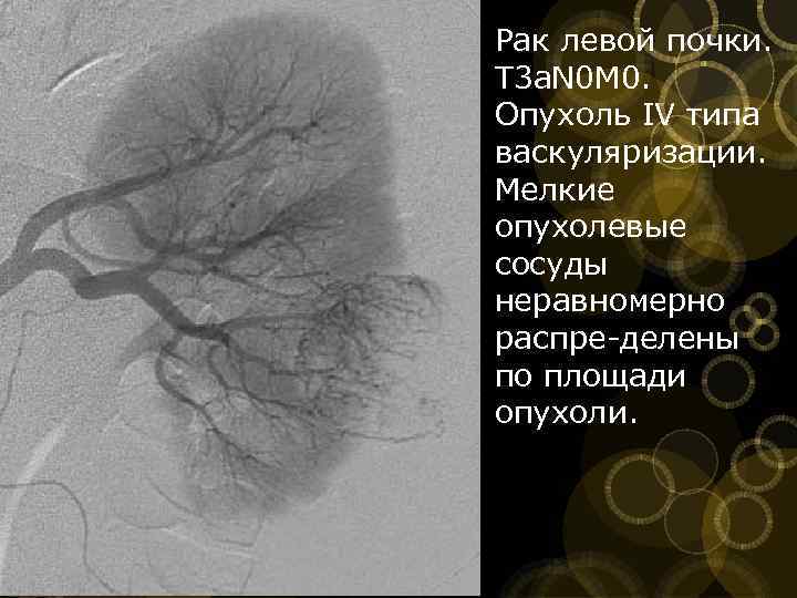 Лучевая диагностика почек презентация