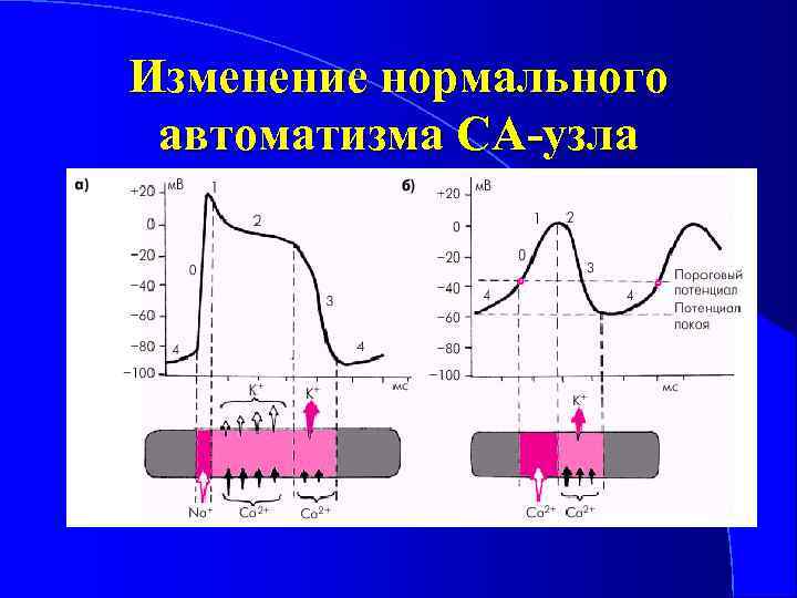 Рассмотрите рисунок с изображением схемы сердца человека как называют нарушение изображенное справа