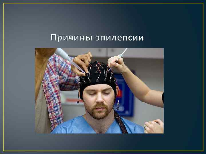  Причины эпилепсии 