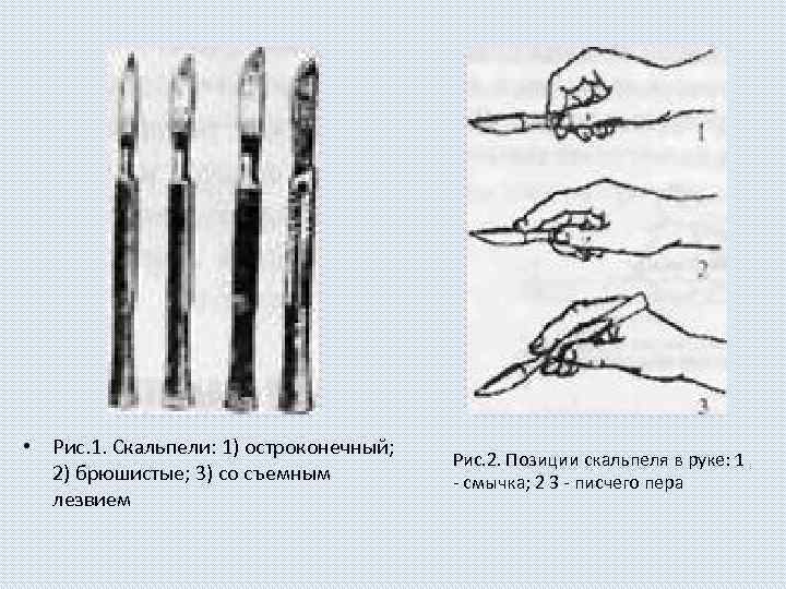  • Рис. 1. Скальпели: 1) остроконечный; 2) брюшистые; 3) со съемным лезвием Рис.