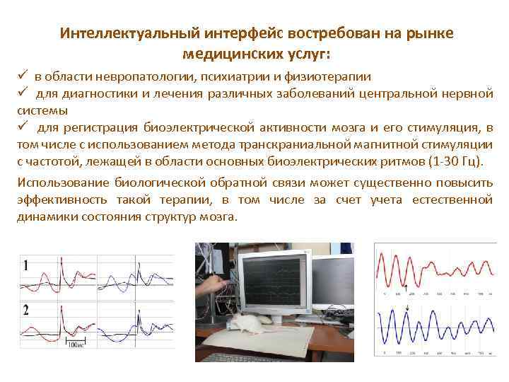 Интеллектуальный интерфейс востребован на рынке медицинских услуг: ü в области невропатологии, психиатрии и физиотерапии