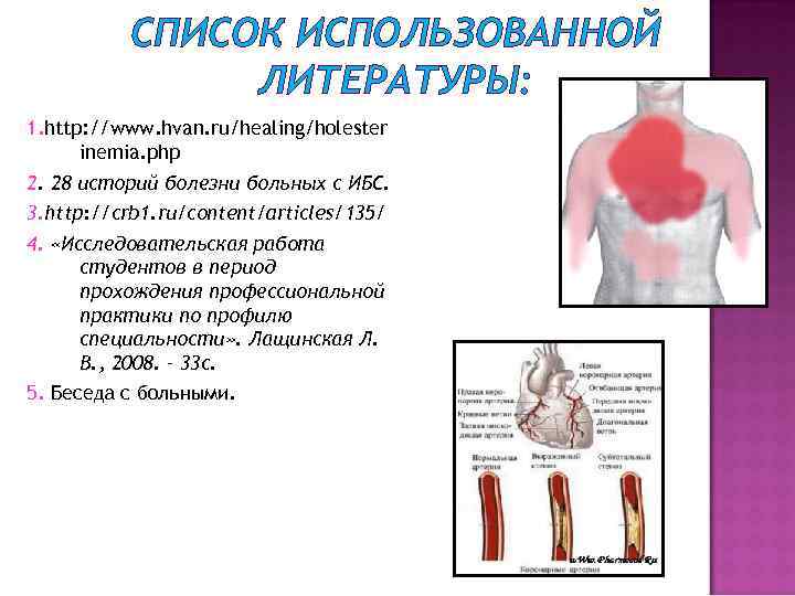 СПИСОК ИСПОЛЬЗОВАННОЙ ЛИТЕРАТУРЫ: 1. http: //www. hvan. ru/healing/holester inemia. php 2. 28 историй болезни