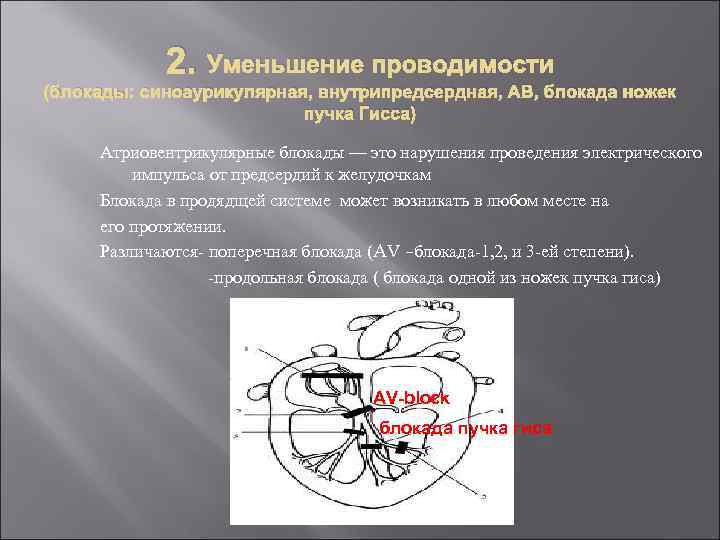 2. Уменьшение проводимости (блокады: синоаурикулярная, внутрипредсердная, АВ, блокада ножек пучка Гисса) Атриовентрикулярные блокады —